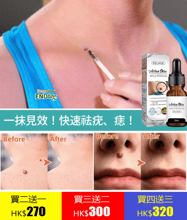 德國最新配方!【皮膚科醫師推薦】EELHOE 點痣克疣精華液 - Image 2
