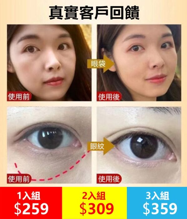 中山大學研製美顔坊蛇毒肽煥顏眼霜 - Image 2