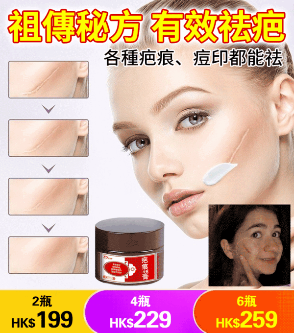【專業祛除幾十年老疤痕】獨創活性修復技術，新老疤痕的剋星，疤痕靈疤痕修護膏 - Image 2