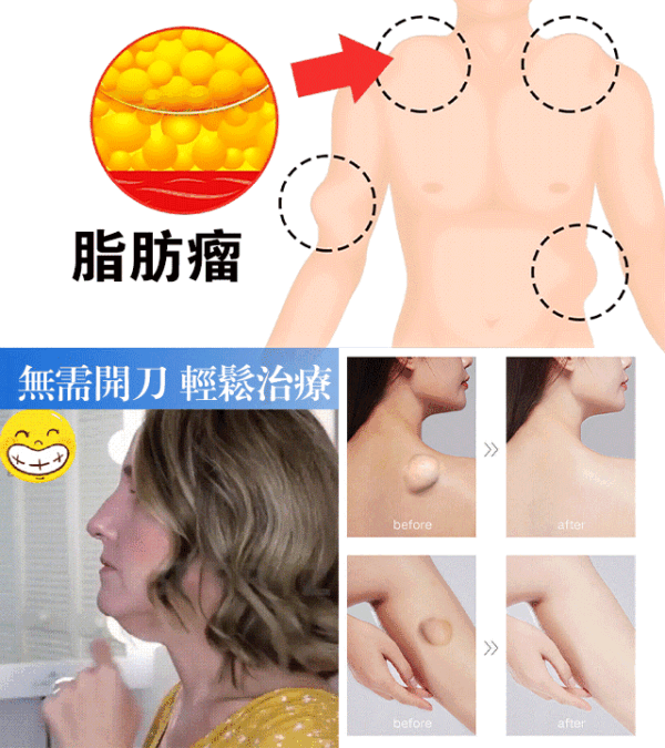 South Moon新款急速消除脂肪結膏 - Image 4