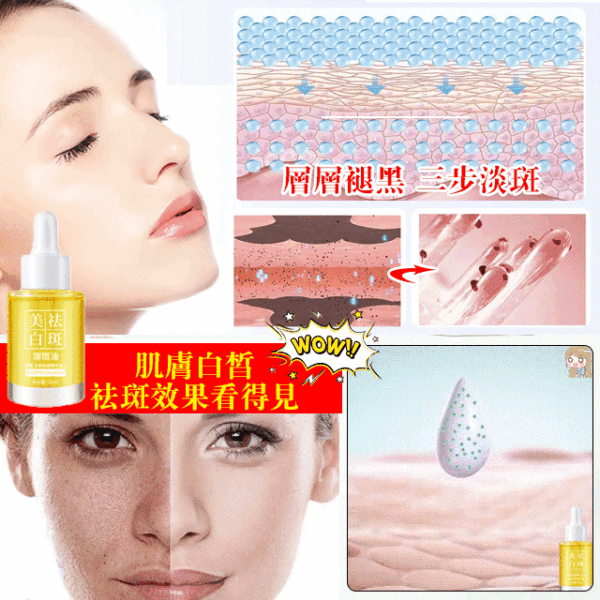 SKSH美白溶斑精油 - Image 2