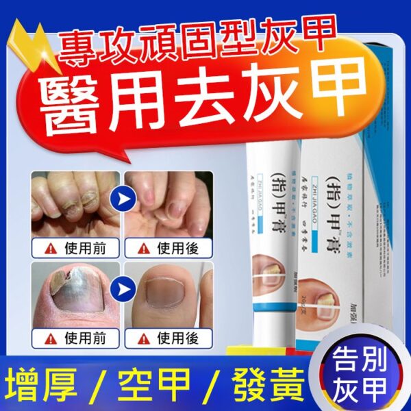 【無痛不復發】灰指甲膏 - Image 4