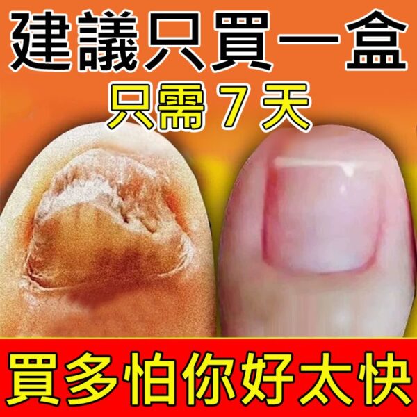 【無痛不復發】灰指甲膏 - Image 5