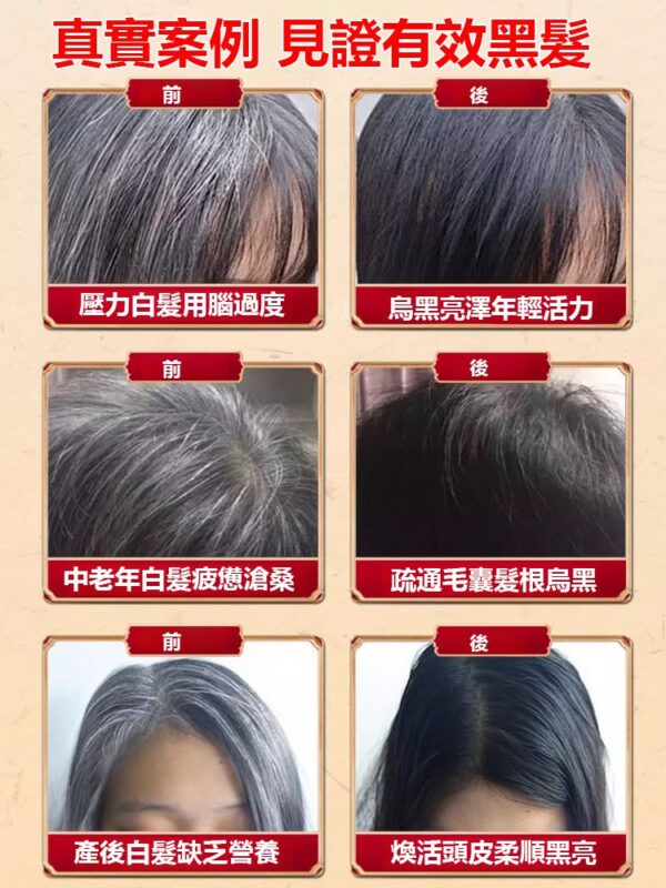 【白髮去無蹤】國藥本草根源黑髮烏參九黑片 - Image 3
