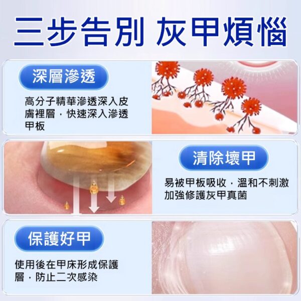 【無痛不復發】灰指甲膏 - Image 7